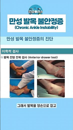 [건강플러스] 만성 발목 불안정증의 진단 방법은? #건강플러스 #만성발목불안정증 #발목인대손상