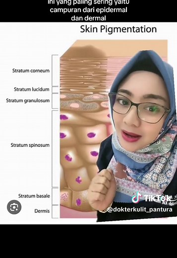 All about MELASMA / FLEK HITAM #melasma #flekhitam #dokterkulitpantura #viral #skincare