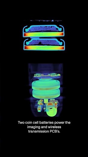 What is a PillCam? CT scans of a PillCam capsule endoscopy camera