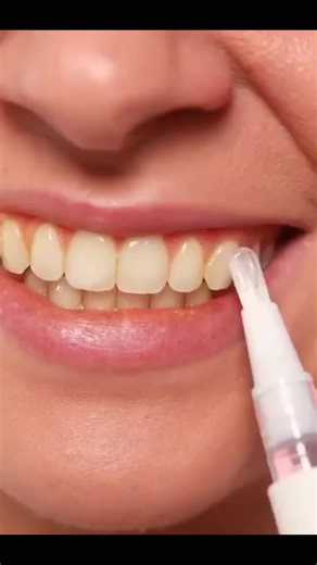 Dazzling Teeth Whitening pen Click the Shop Know Button or got to my website discounterhub.shop