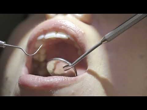 Orchid™ LED Headlight for Loupes - Admetec