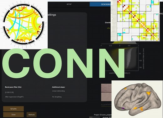 CONN功能连接系列视频-04 组水平分析-可视化 | 静息态任务态fMRI 功能连接 ALFF REHO