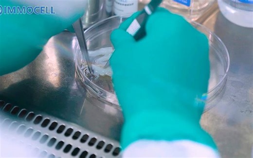 第四节：人脐带间充质干细胞的制备