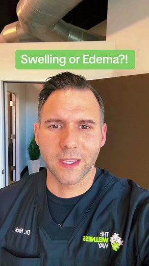 Swelling or Edema?! #thewellnessway #thewellnesswaysouthjordan #thedoctornick #thedoctordon #fyp #wedontguesswetest #adifferentperspective #inflammation #swelling #edema #diabetes #injury