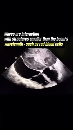 What is “Smoke” on Echo?