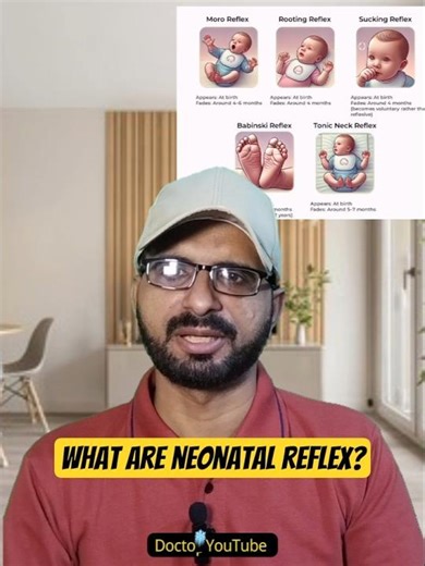What are neonatal reflex?🤔🤔#youtubeshorts #shorts