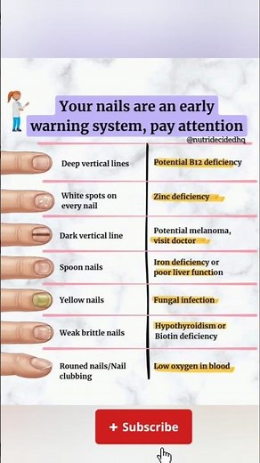 White Spots on Nails? Here’s the Real Reason Behind Them 😳 #shorts #nails #nutrition
