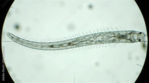 Microscopic observation of a Nereis polychaete, a marine annelid worm commonly known as a ragworm or clamworm, showing its segmented body and bristles