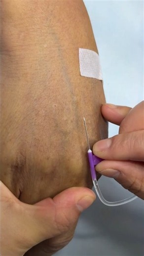 How to Give IV Injection Safely | Step-by-step Intravenous technique |perfectly IV & IM injection💉29