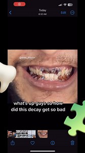 21K views | Meth Mouth 邏里 | Kapadia Dental Care PLC | Facebook