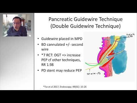 ERCP TIPS AND TRICKS: DIFFICULT BILIARY CANNULATION - HiDef