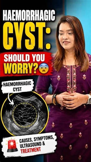 Haemorrhagic Cyst Symptoms You Shouldn't Ignore #pain #medicaleducation #healthtips
