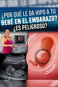 ¿Por qué le da hipo a tu bebé en el embarazo? ¿Es peligroso? Ingrid Montejano - Dra Mónica Malagón | Badabun