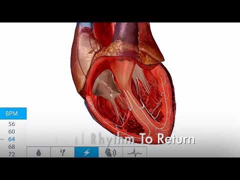 Defibrillation vs Cardioversion 🚑 ACLS Emergency Rhythm Management #aclscertification #acls