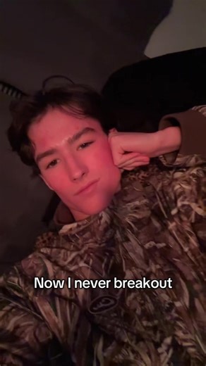 Skincare Solution for Post-Gym Breakouts