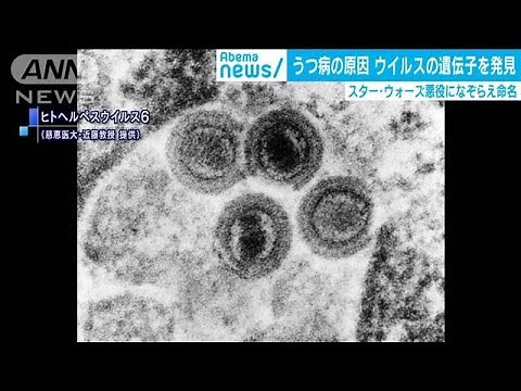 “うつ病の原因”となるウイルスの遺伝子を発見(2020年6月19日)