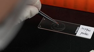 Author Spotlight: RNA FISH for Locating lncRNA-SNHG6 in Osteosarcoma Cells