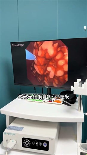 Revolutionary Lithotripsy Success for Village Dogs in 2026