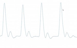 【好玩模块】Pulse Sensor心率、脉搏、心跳波形检测模块，糟糕，是怦然心动的感觉