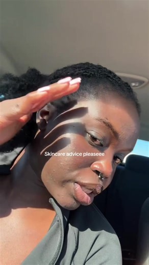 #stitch with @Theodora | Fitness & love thanks everyone for the advice and prayers. #skincare #darkskin #fyp