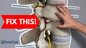 How to Fix a Bulging Disc in Your Lower Back | St. Joseph, MI Chiropractor