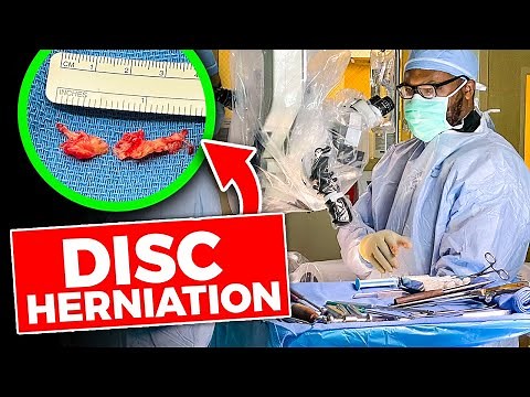INSIDE THE OR: Microdiscectomy for Lumbar Disc Herniation
