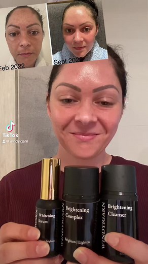 Reduce Hyperpigmentation in 4 Weeks with This Simple Skincare Routine