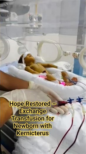 “Golden Baby Saved from Jaundice – Exchange Transfusion Journey 💛”