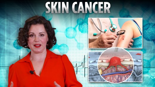 DIY cancer checks must know - as half of Brits wait over a month for diagnosis