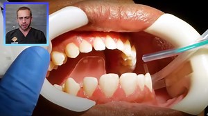 類 Have you ever wondered what the process is like to get braces put on? Some people think its the really long and painful process.. BUT in fact it's quite simple and pain-free when done right! In this video Dr. Ty from Premier Orthodontics breaks down & walks you through the entire process step-by-step of getting Braces Installed! | Premier Orthodontics | Facebook