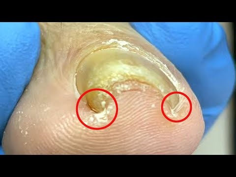 Pedicure Tutorial Super Curly Nails With A 180 Degree Bend