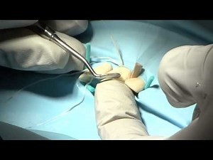 Incisal Edge • Video • MEDtube.net