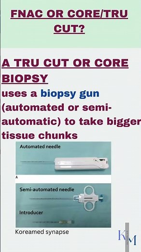 FNAC or TRU CUT/ CORE BIOPSY? || BREAST FNAC VS CORE BIOPSY EXPLAINED || HISTOPATHOLOGY OF BREAST