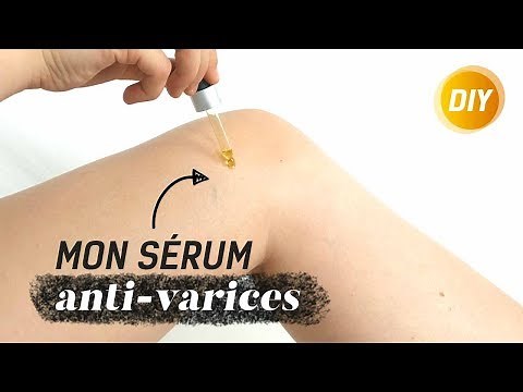 Comment soigner ses varices au naturel - DIY