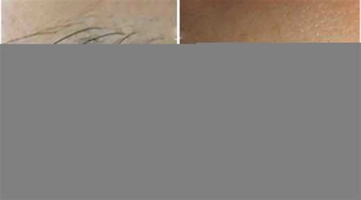 5.4K views · 52 reactions | How to use coconut oil to permanently get rid of unwanted hair on the face and body. | Health guru | Facebook