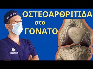 Τι είναι η Οστεοαρθρίτιδα Γόνατος; Μάθετε σε 2 λεπτά! #orthopaidikos