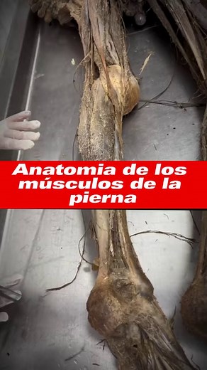 🦵 Anatomía de los Músculos de la Pierna 🦵 La pierna está compuesta por una compleja red de músculos que permiten movimiento y estabilidad. #yosoyaifcf #todossomosaifcf #fypシ゚ #anatomiahumana #CienciasForenses #interesante #pierna | Academia Internacional de Formación en Ciencias Forenses