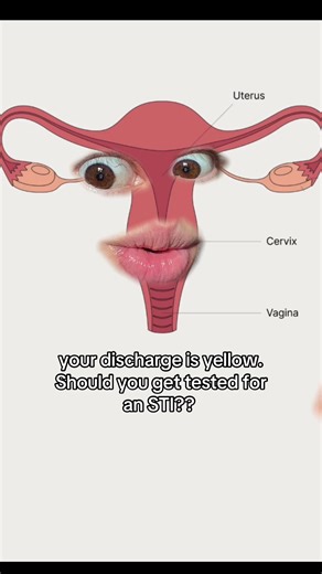Signs of STIs: What Your Discharge Color Means