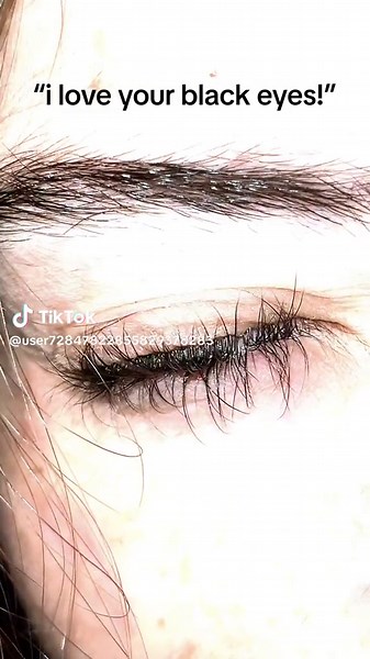 Black and Brown Eyes: Natural Beauties Explained