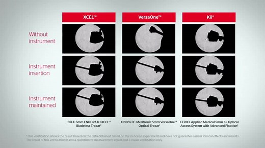 ENDOPATH XCEL® Trocars with OPTIVIEW® Technology | Ethicon