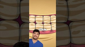 Don't eat toothpaste, here's why with @MeetArnold-en + St. Paddy’s Day food vs cavities?