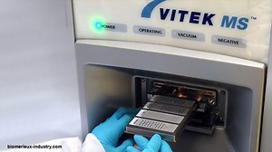 Vitek MS, Hanya Dua Detik Identifikasi Bakteri dalam Darah