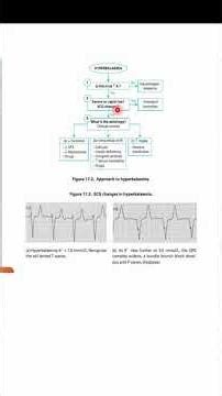 Algorithm 15 : Hyperkalemia
