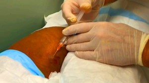 Meta-Seven (30 Day): https://amzn.to/2O11zhK Meta-Seven (90 Day): https://amzn.to/2LNE3SD Dr. G's Blackhead Tools: https://amzn.to/32Dr7FQ Coco Skin Plus: https://amzn.to/2Q5fPZy Meta-Seven (360 Day): https://amzn.to/2NZZD9u Dr. Gilmore's Store: http://www.shopgilmore.com Meta-Seven (Canada): https://www.amazon.ca/s/ref=nb_sb_noss_2?url=search-alias=aps&field-keywords=meta-seven There are links on this site that can be defined as “affiliate links”. This means that I may receive a small commissio