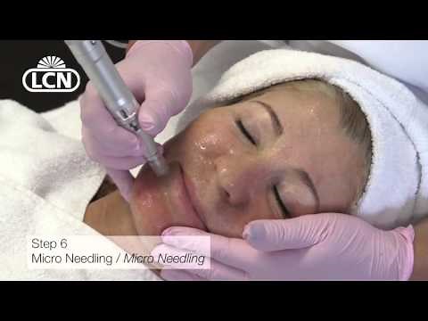 Micro Needling Tutorial mit dem Mobile Pen und Tipps von LCN