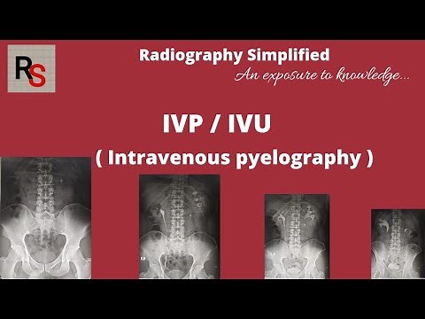 IVP ll Intravenous pyelography ll Intravenous urography ll Radiography simplified ll