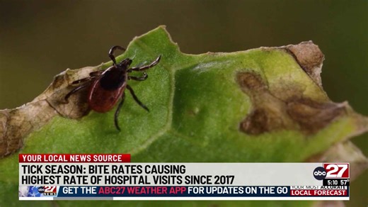 Tick bites causing highest rate of ER visits in a decade: CDC