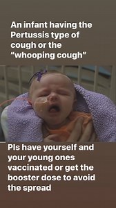 3.1M views · 10K reactions | What is Whooping Cough or Pertussis | Kids' Clinic-Mactan | Facebook