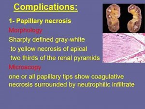 Diseases of the tubules and interstitium - Pathology (3) | Renal System