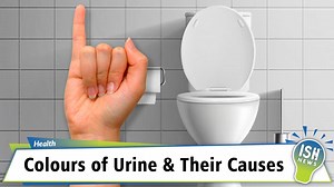 Doctors’ call the normal colour of the urine “urochrome”. Urochrome Urine naturally has a yellow pigment (shade). For Example: If you are hydrated i.e. you have drunk enough water, then the urine would be light yellow. If you are dehydrated i.e. you have less water in the body, the urine would be amber. Sometimes the food or the medicines you eat can go through your digestive tract and the colour of the urine may change. Sometimes the colour of the urine shows a serious health condition for whic